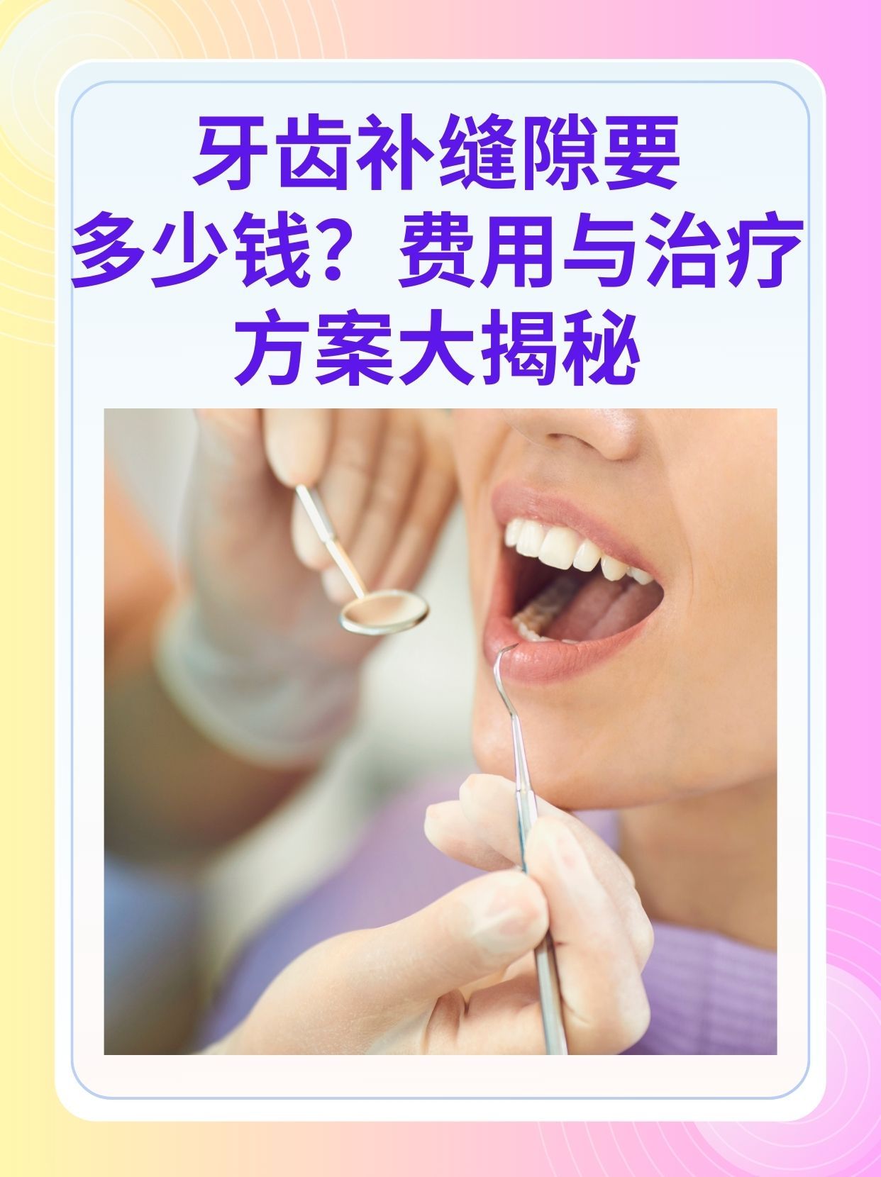 包头补牙医保可以报销吗(补牙医保可以报销吗 哪些可以报销呢)